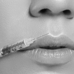 fillers komplikationer